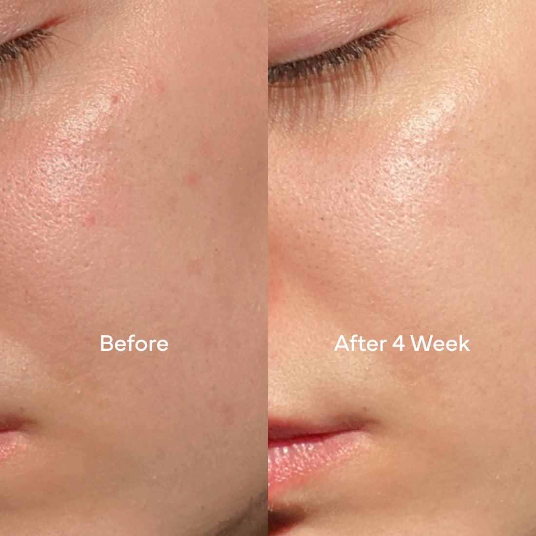 Dew Defence Day Cream With Neurobiox